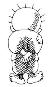 Handala